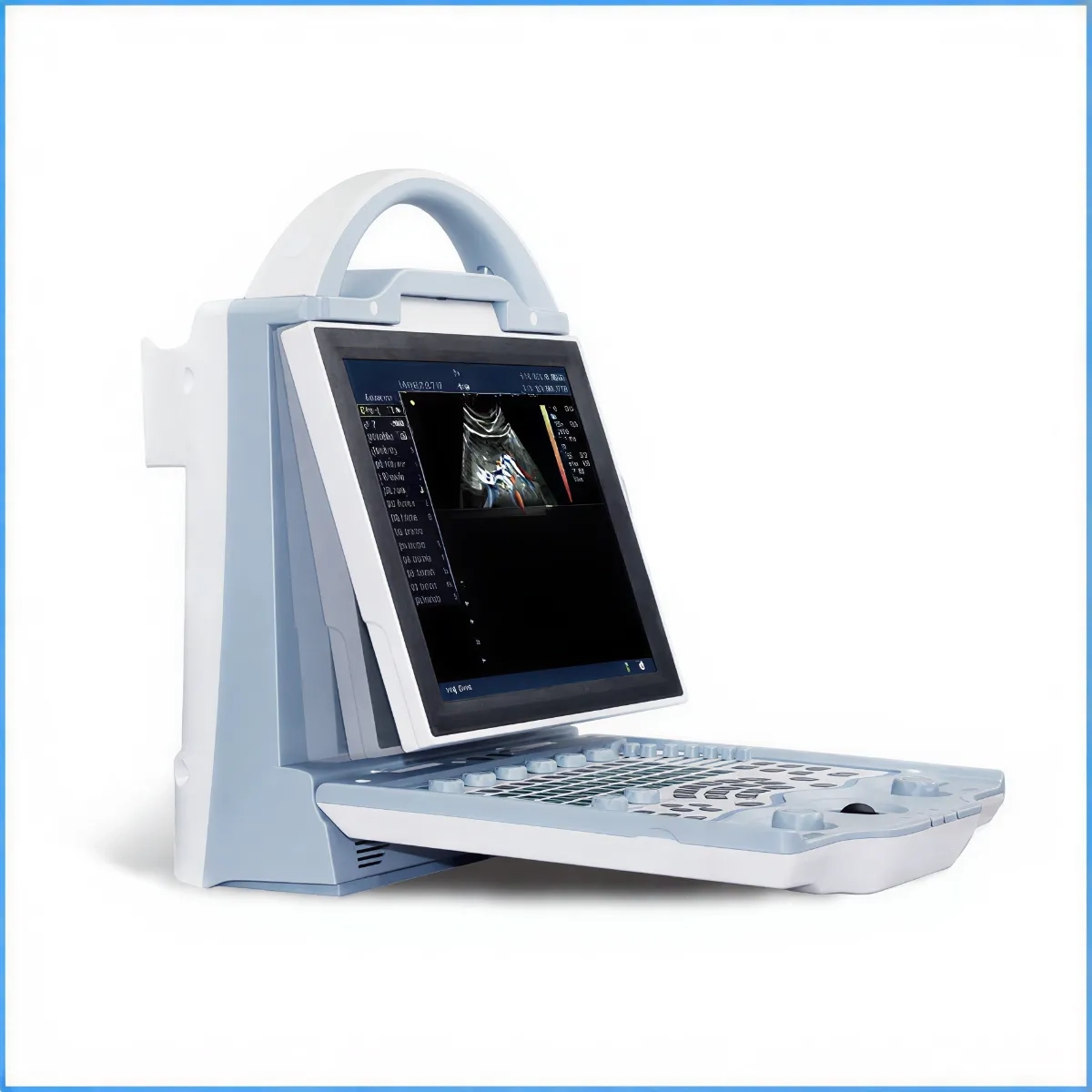 УЗД Mindray DP10 (УЗД-сканер).