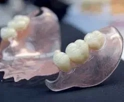 Пресовка-інжекція нейлонових протезів високої якості