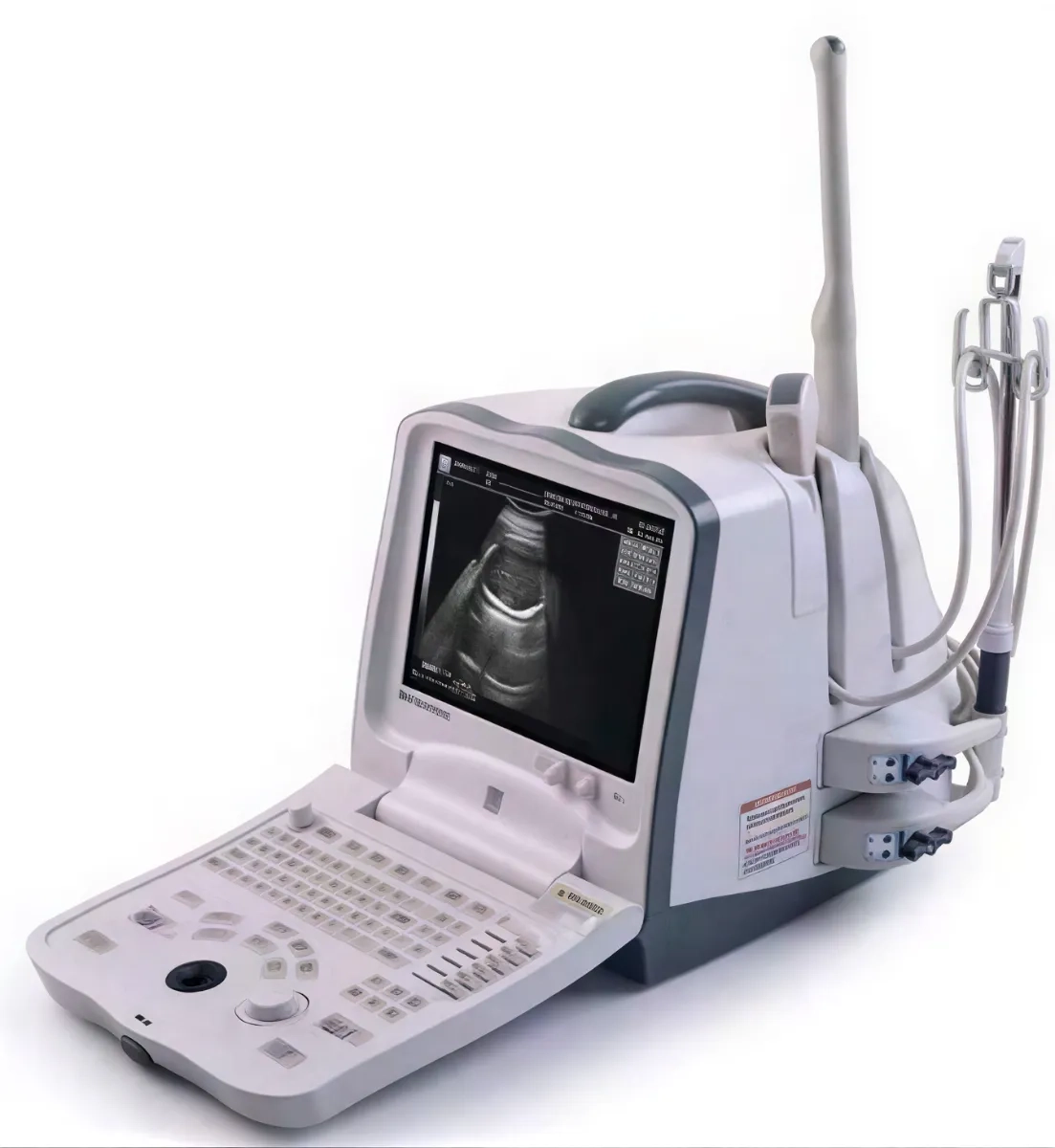 Mindray DP-6600 портативний УЗД апарат для діагностики