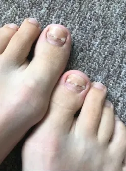 Педікюр подолог виізд