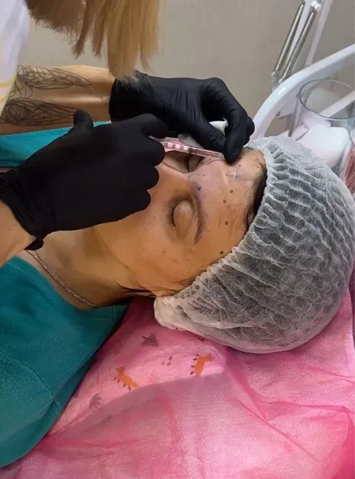 Косметолог в Миколаєві естетичні та інʼєкційні процедури