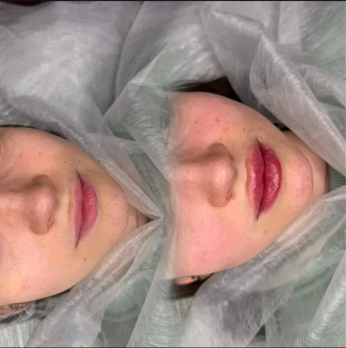 Косметолог в Миколаєві естетичні та інʼєкційні процедури