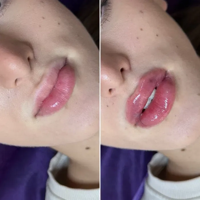 Косметолог в Миколаєві естетичні та інʼєкційні процедури