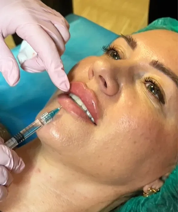 Косметолог в Миколаєві естетичні та інʼєкційні процедури