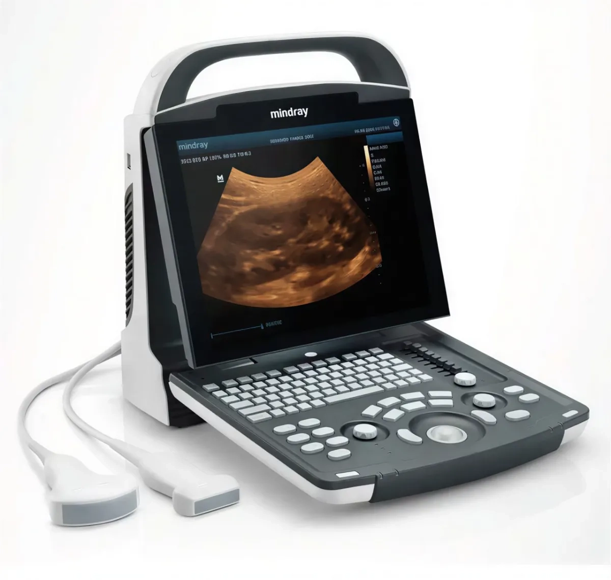 Апарат Mindray DP-10 для кабінету УЗД