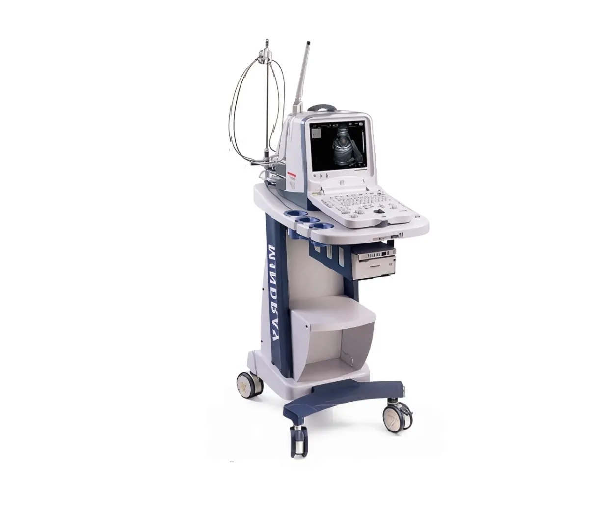 УЗД апарат Mindray DP-6600 - точна діагостика