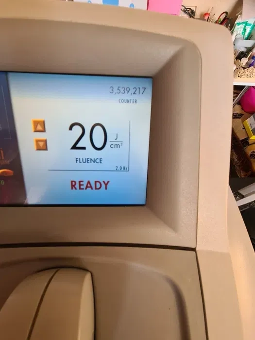 Діодний лазер