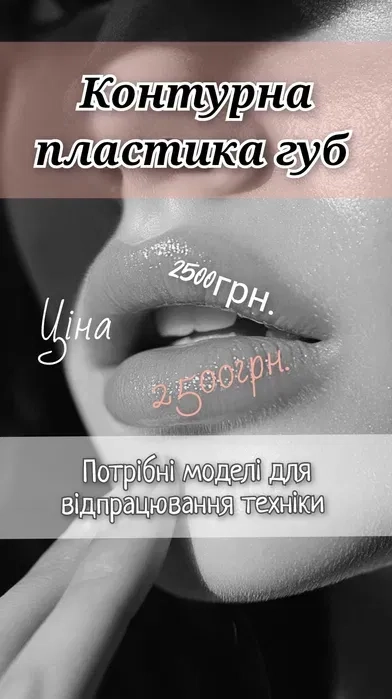 Контурна пластика губ!