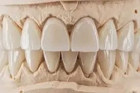 Зубний технік з досвідом: естетика, точність, результат