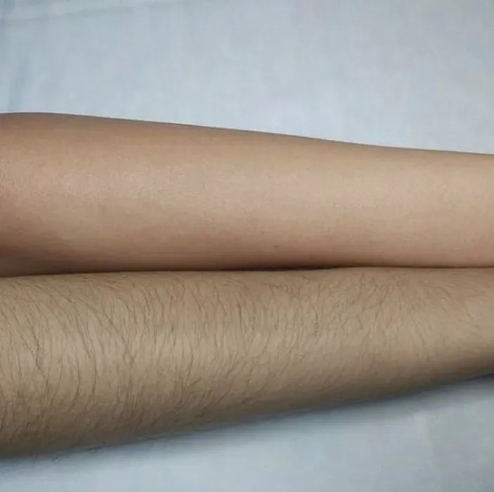 Шугаринг львів пр Чорновола 180 грн.