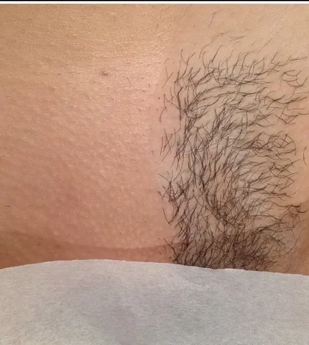 Шугаринг львів пр Чорновола 180 грн.