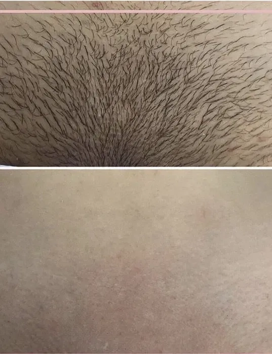 Шугаринг львів пр Чорновола 180 грн.