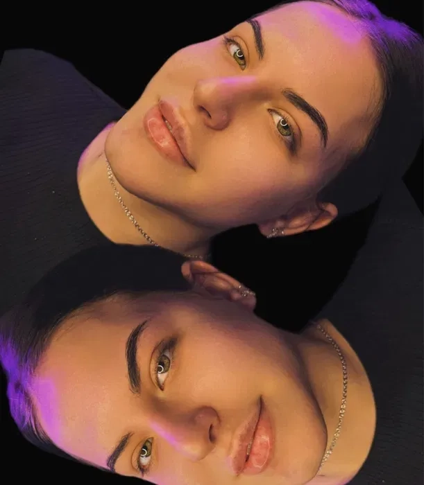 Красиві губи — професійне збільшення