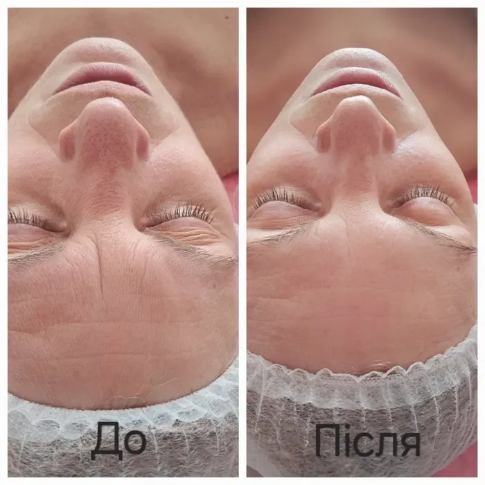 Косметолог. Массаж обличчя. Чистка обличчя. Пілінги.