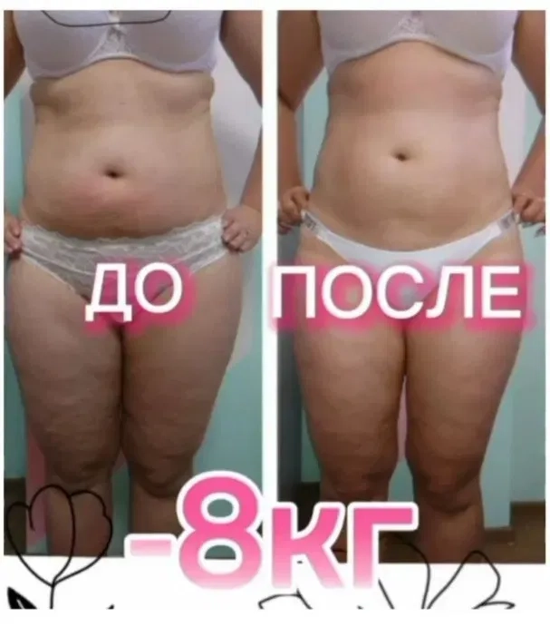 Професійний масаж та тейпування, 7 Лінія ЖК "Парковий"