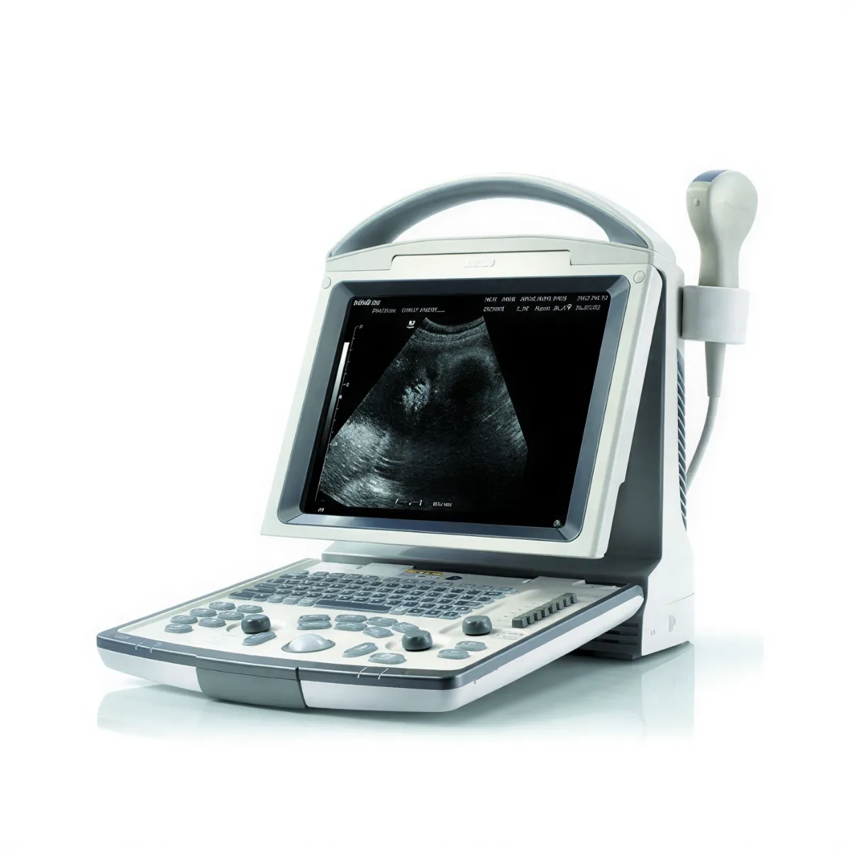 Ультразвуковий апарат Mindray DP-3300