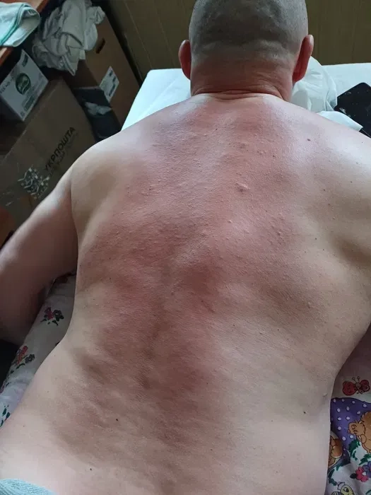 Ефективний лікувальний масаж спини