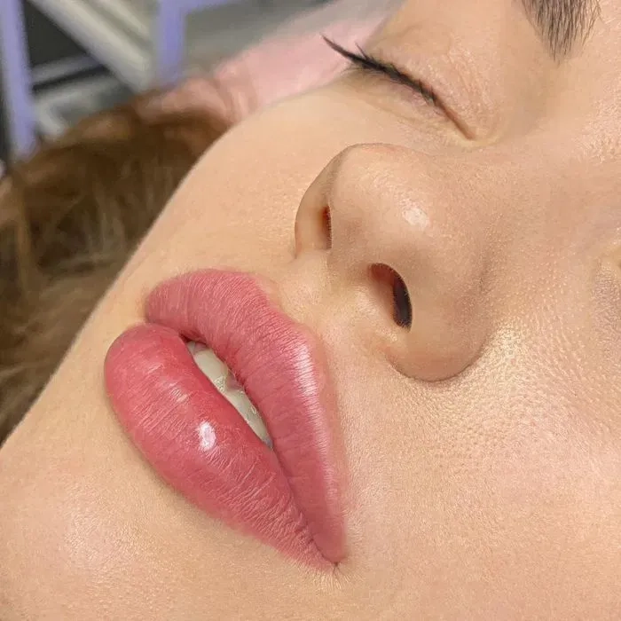 Косметолог-ін’єкціоніст з медичною освітою | м. Харківська