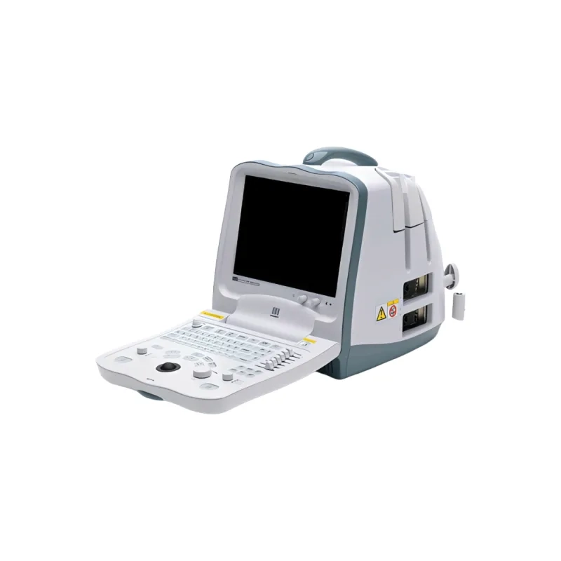 Апарат УЗД Mindray DP-6600 - надійний помічник