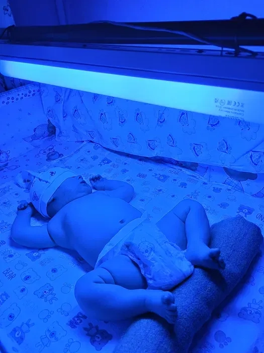 Лампа от желтухи, лампа від жовтяниці