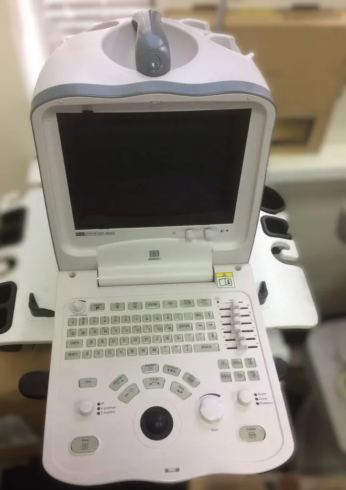 Портативний ультразвуковий сканер Mindray DP-6600