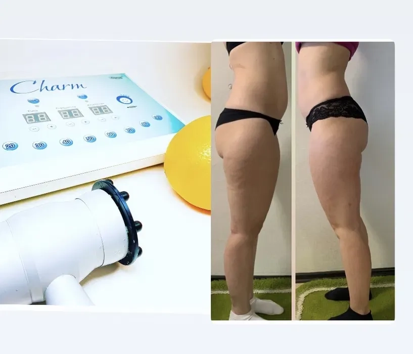 Масаж массаж Charm БМС тіла обличчя Шарм 400 грн.!