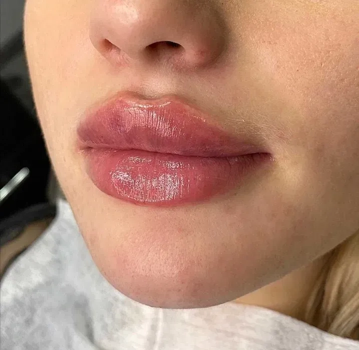 Акція! -30%! Збільшення губ у техніці плоский бант.