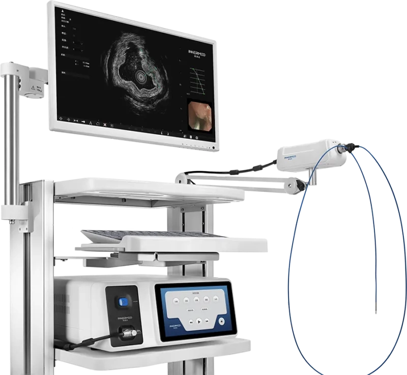 Ендоскопічна ультразвукова система INNERMED