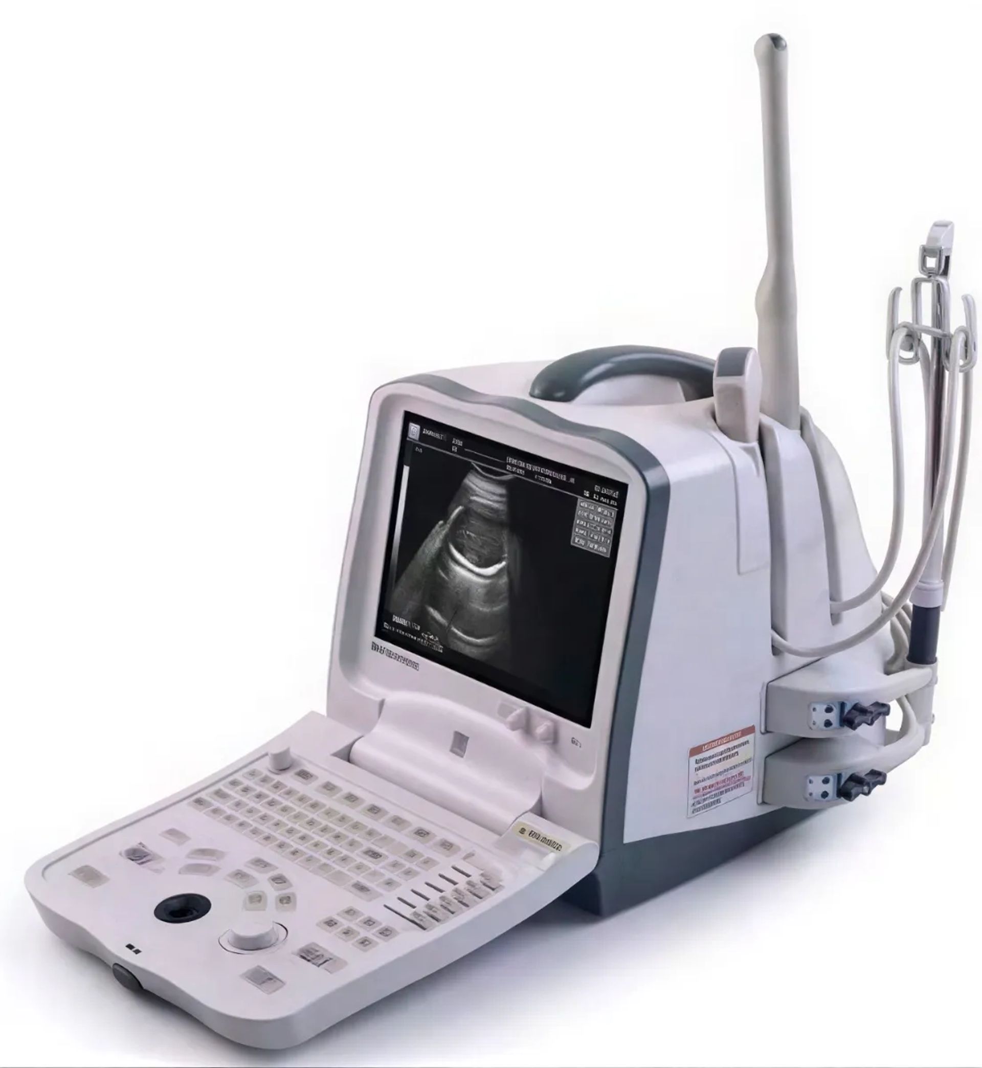 Mindray DP-6600 портативний УЗД апарат для діагностики