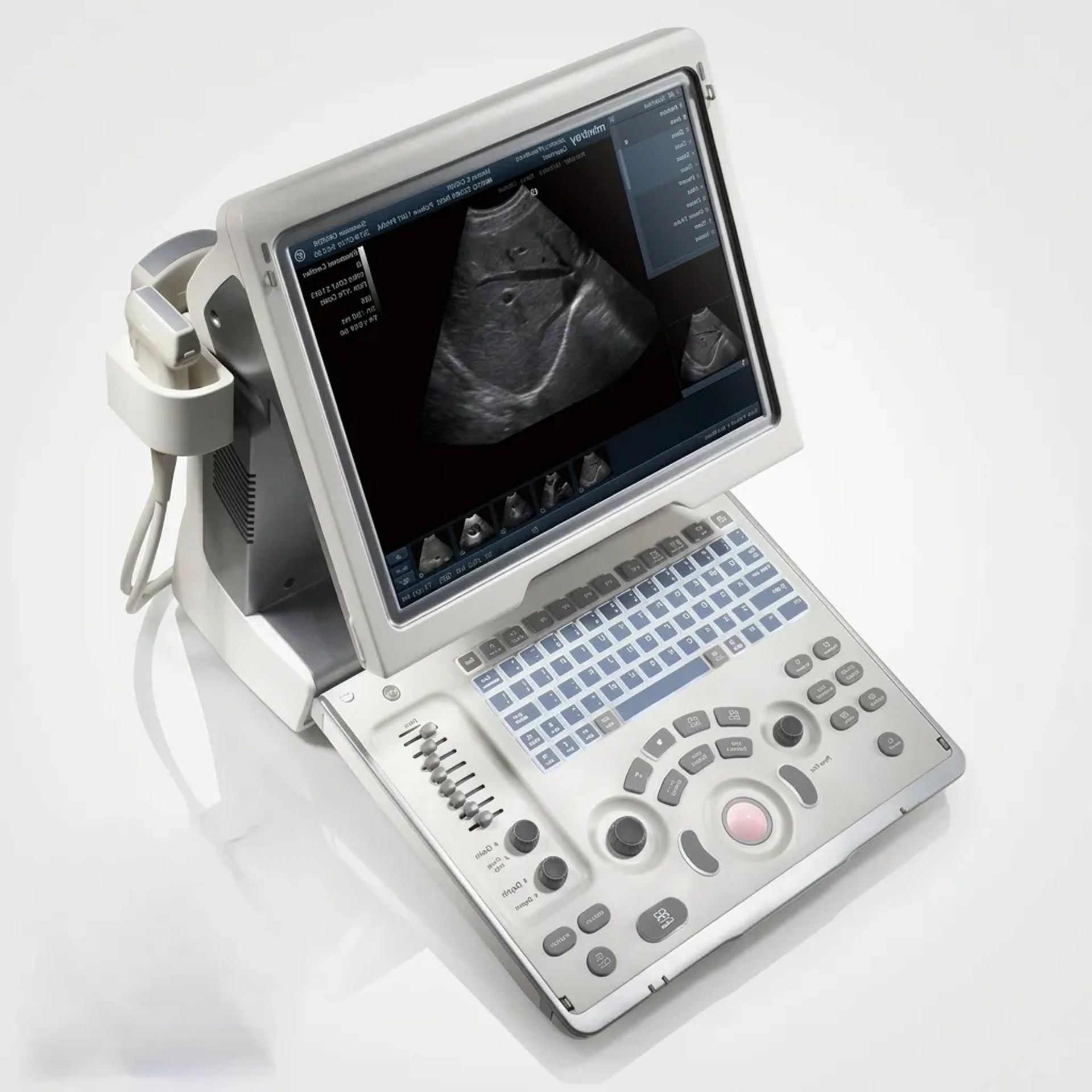 Діагностичний УЗД апарат Mindray DP10