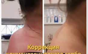 Професійний Лікувальний Масаж Спини. Висока якість, зручна локація (Лівий берег).