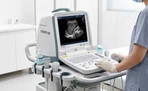 Mindray DP-6600 портативний УЗД апарат для діагностики