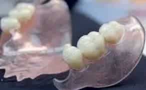 Пресовка-інжекція нейлонових протезів високої якості