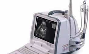 Mindray DP-6600 портативний УЗД апарат для діагностики