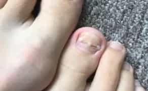 Педікюр подолог виізд