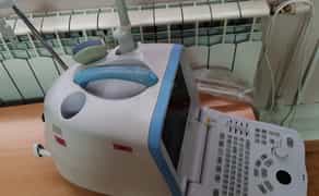 Сканер УЗД портативний ультразвуковий