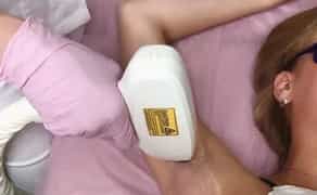 Лазерная эпиляция, лазер правый берег, Бородинский