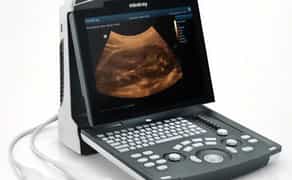 Апарат Mindray DP-10 для кабінету УЗД