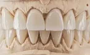 Зубний технік з досвідом: естетика, точність, результат