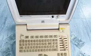 Mindray DP-6600 — компактний портативний УЗД апарат