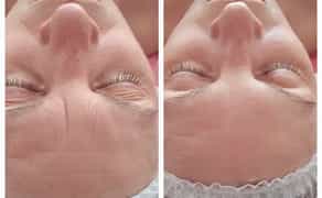 Косметолог. Массаж обличчя. Чистка обличчя. Пілінги.