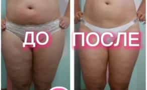 Професійний масаж та тейпування, 7 Лінія ЖК "Парковий"