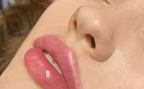 Косметолог-ін’єкціоніст з медичною освітою | м. Харківська