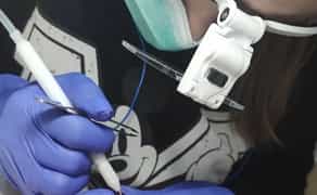 Електроепіляція та воскова депіляція. 10 років досвіду. Центр Бучі.