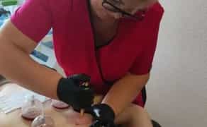 Волога та суха хіджама