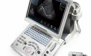 УЗД апарат Mindray DP10— Надійність та мобільність діагностики