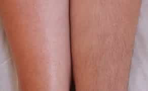 Шугаринг, воск! Троещина! Работаю профессиональными материалами