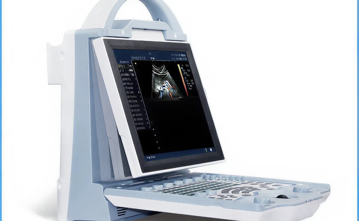 УЗД Mindray DP10 (УЗД-сканер).