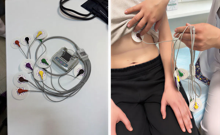 Добовий монітор ЕКГ (Холтер) з ПЗ