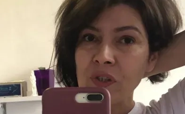 Електроепіляція. Косметолог. Навчання електроепіляції.